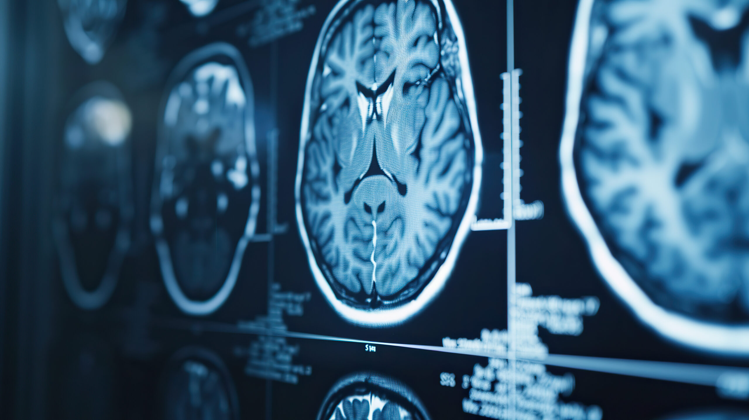 Examen de radiologie cérébrale